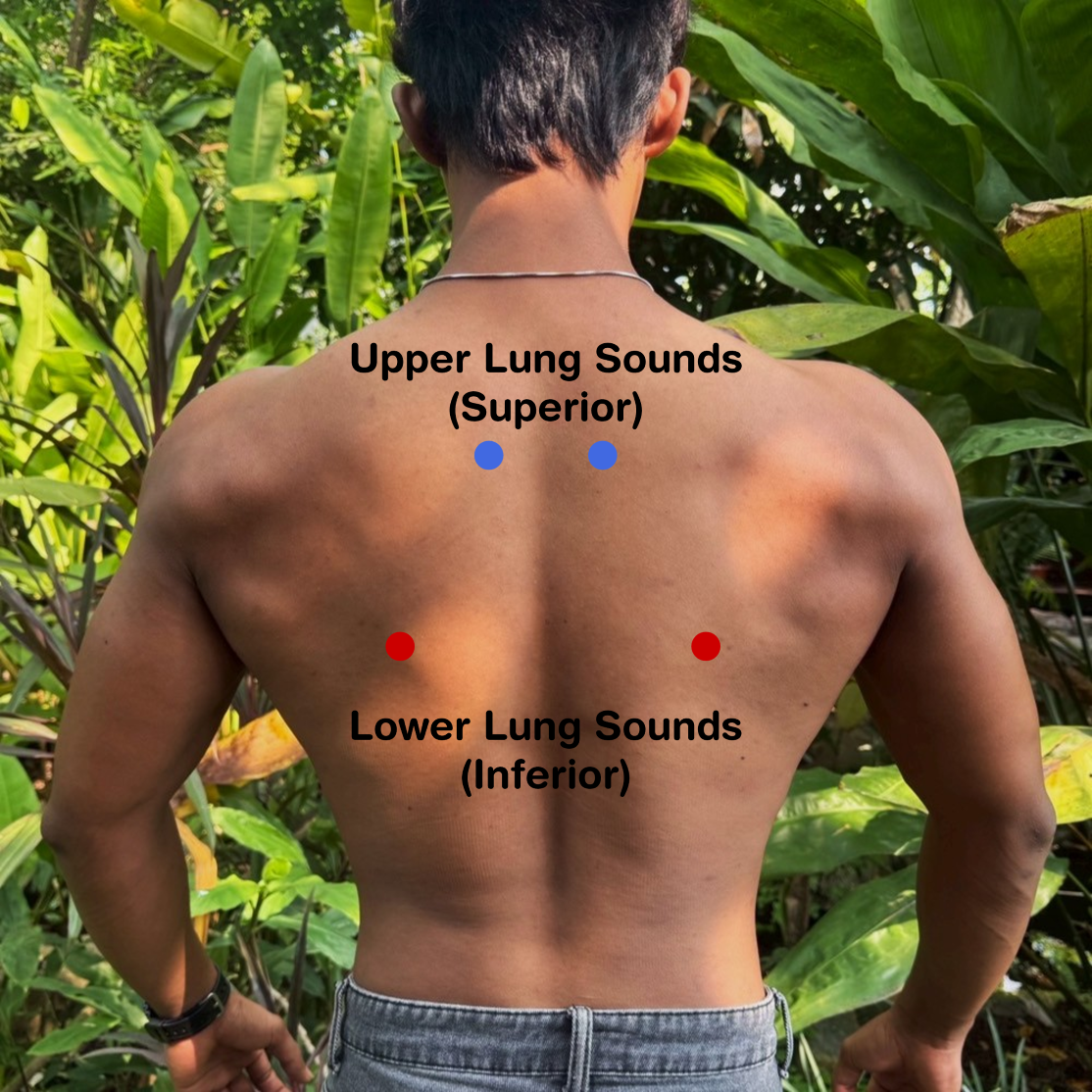 Positions for Upper and Lower Lungs Sounds on the Back Patient’s back with the positions marked for upper and lower lung sounds